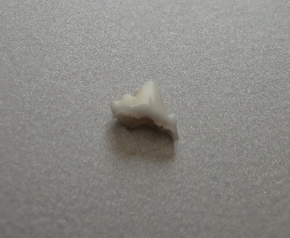 DSC03652 くぅちゃん乳歯②