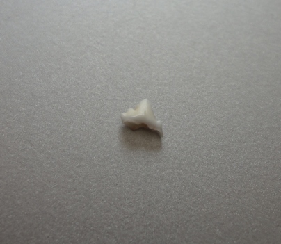 DSC03653 くぅちゃん乳歯③